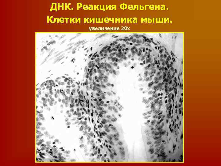 ДНК. Реакция Фельгена. Клетки кишечника мыши. увеличение 20 х 