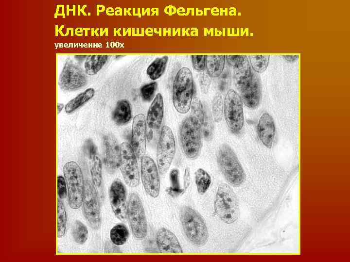 ДНК. Реакция Фельгена. Клетки кишечника мыши. увеличение 100 х 
