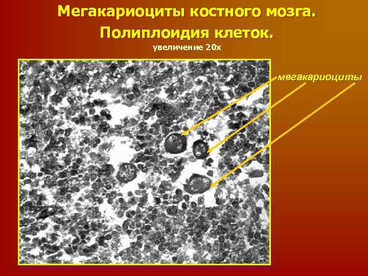 Увеличение клеток. Мегакариоциты в костном мозге. Мегакариоцит строение. Морфология мегакариоцитов. Клетки образующиеся из мегакариоцитов.