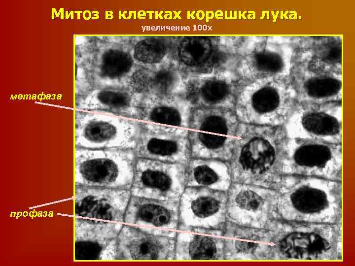 Рисунок митоз в клетках корешка лука