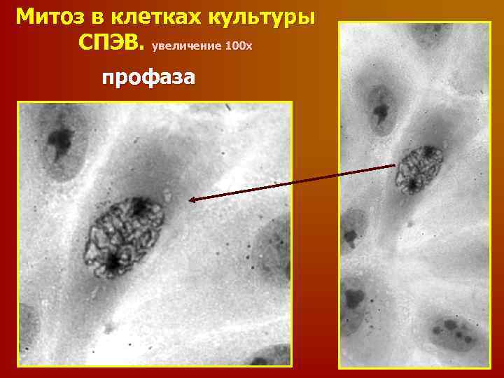 Митоз в клетках культуры СПЭВ. увеличение 100 х профаза 