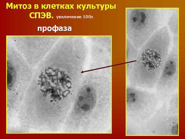 Митоз в клетках культуры СПЭВ. увеличение 100 х профаза 