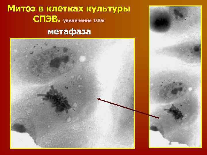 Митоз в клетках культуры СПЭВ. увеличение 100 х метафаза 