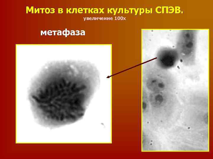 Митоз в клетках культуры СПЭВ. увеличение 100 х метафаза 