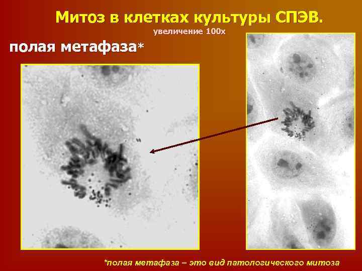 Митоз в клетках культуры СПЭВ. увеличение 100 х полая метафаза* *полая метафаза – это
