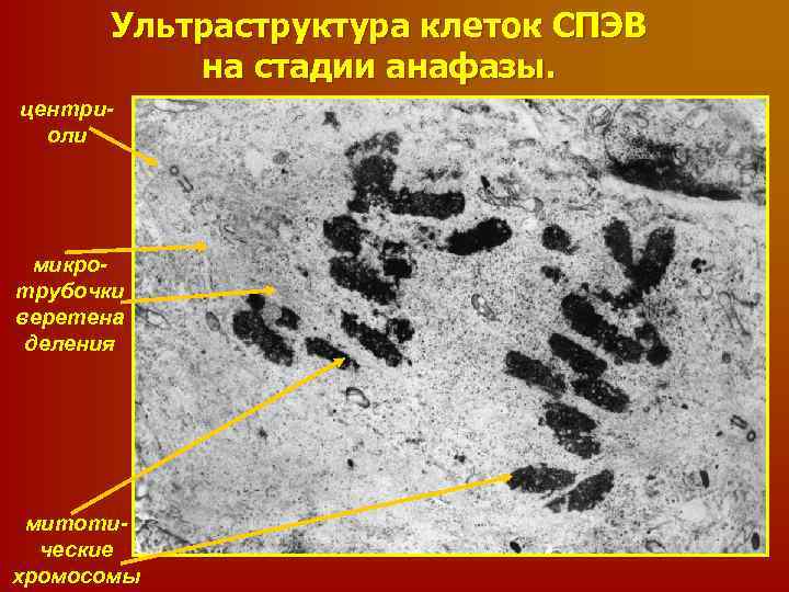 Ультраструктура клеток СПЭВ на стадии анафазы. центриоли микротрубочки веретена деления митотические хромосомы 