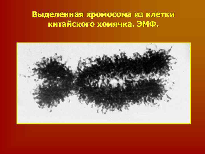Выделенная хромосома из клетки китайского хомячка. ЭМФ. 
