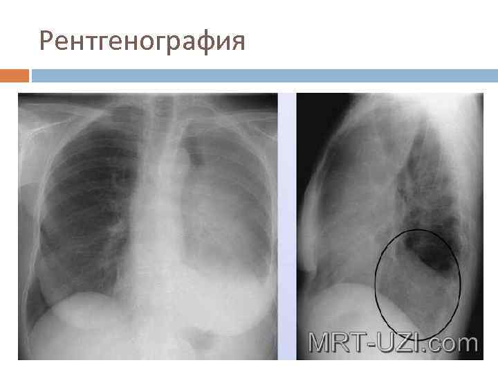 Рентгенография 