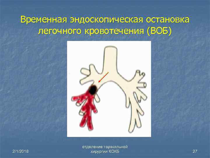 Легочные кровотечения картинки