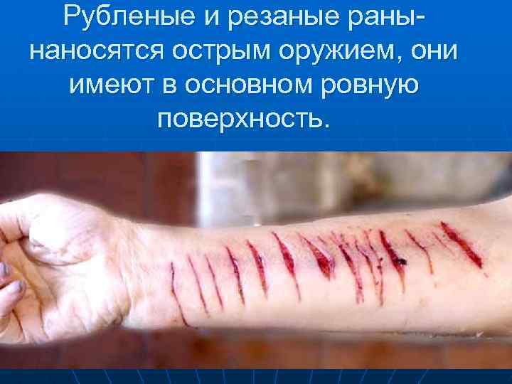 Рубленые и резаные ранынаносятся острым оружием, они имеют в основном ровную поверхность. 