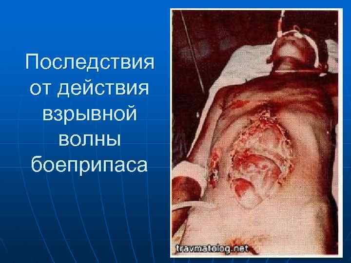 Последствия от действия взрывной волны боеприпаса 