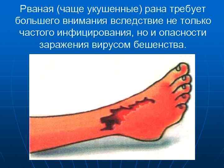 Рваная (чаще укушенные) рана требует большего внимания вследствие не только частого инфицирования, но и