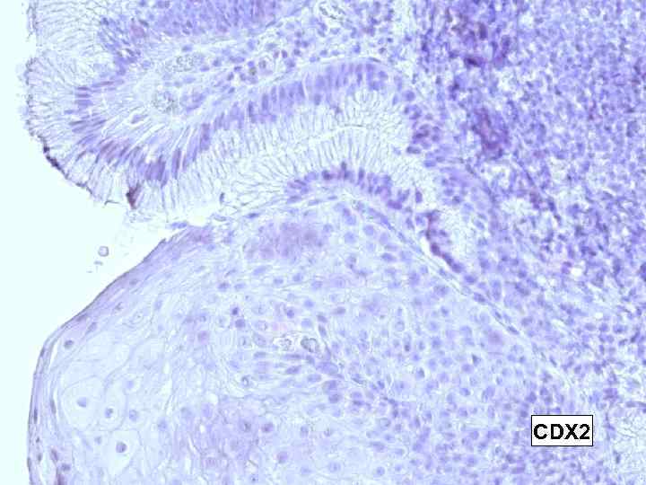 CDX 2 