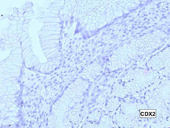 CDX 2 