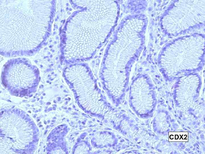 CDX 2 