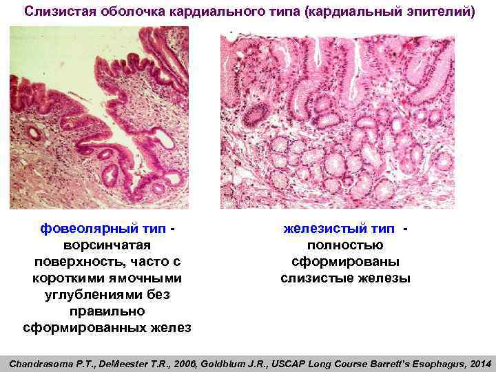 Типы слизистой. Кардиальные железы желудка гистология. Кардиальные железы пищевода гистология. Железы слизистой оболочки.