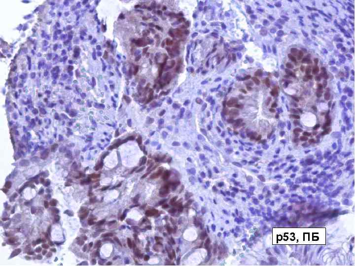 р53, ПБ 