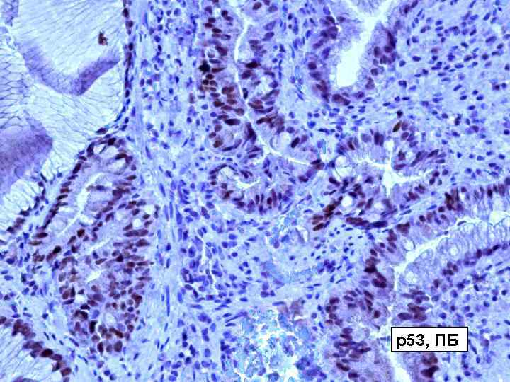 р53, ПБ 