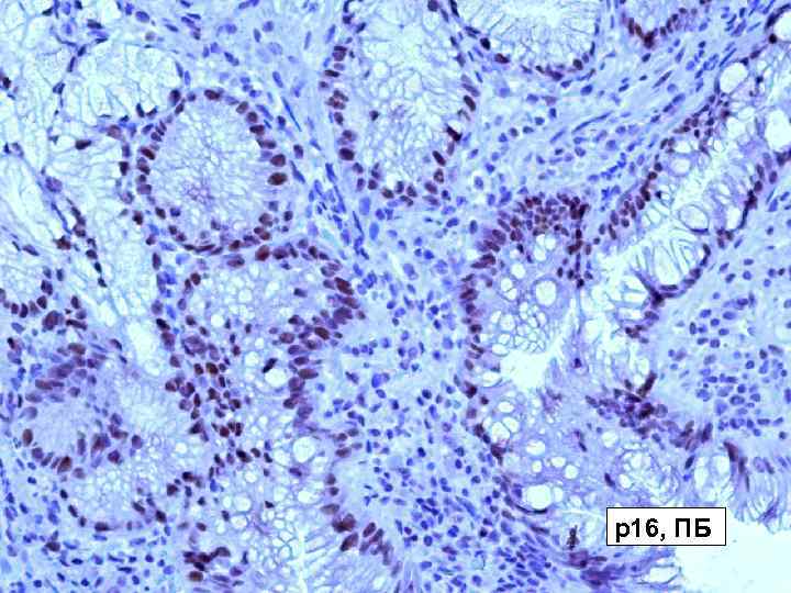 р16, ПБ 