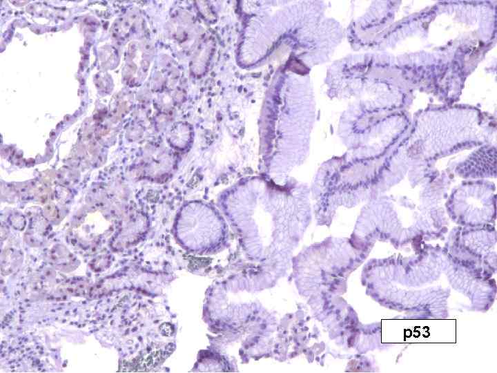 р53 