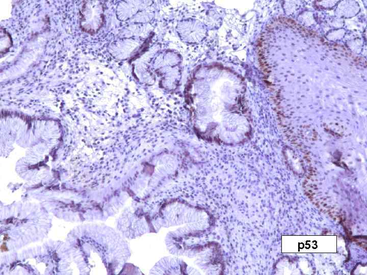 р53 