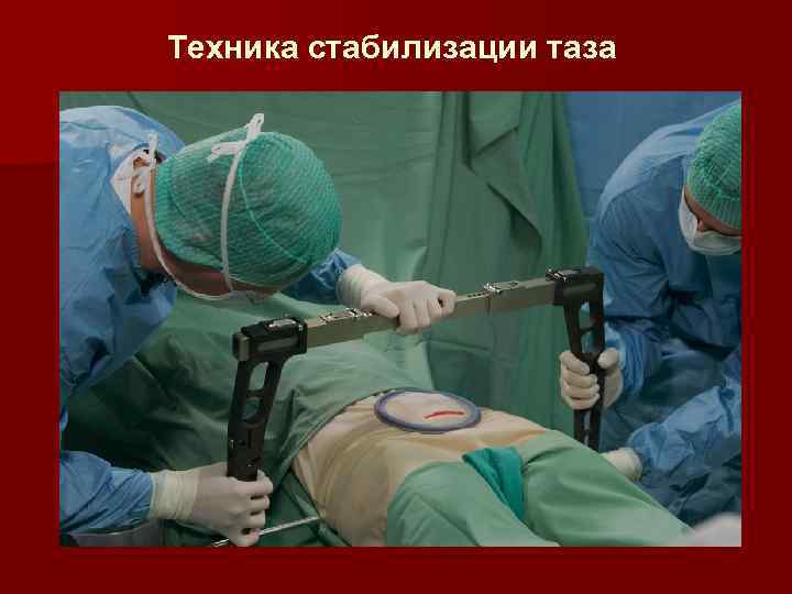 Техника стабилизации таза 