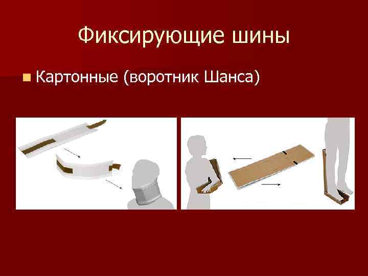 Фиксирующие шины n Картонные (воротник Шанса) 