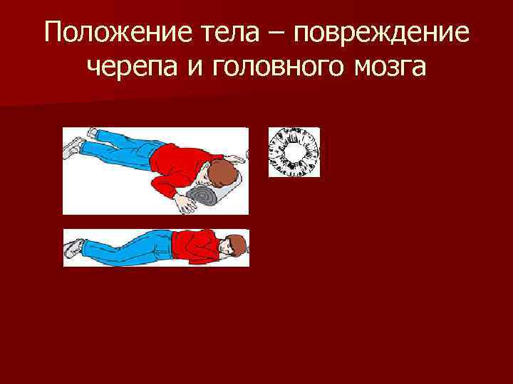 Положение тела – повреждение черепа и головного мозга 