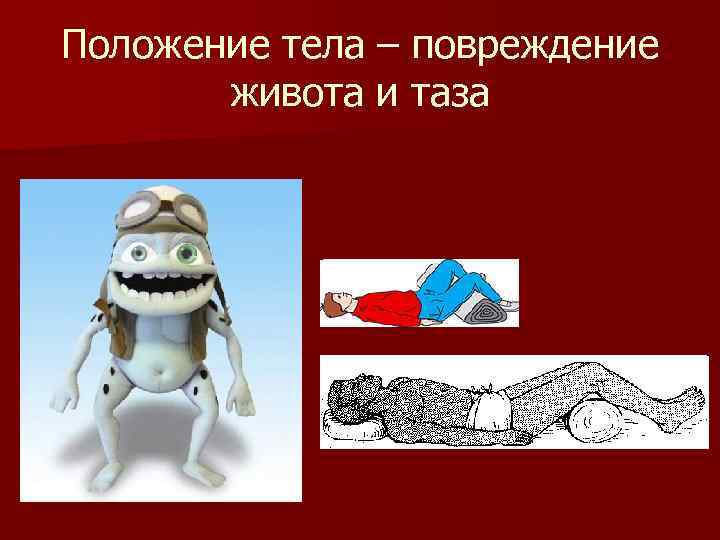 Положение тела – повреждение живота и таза 