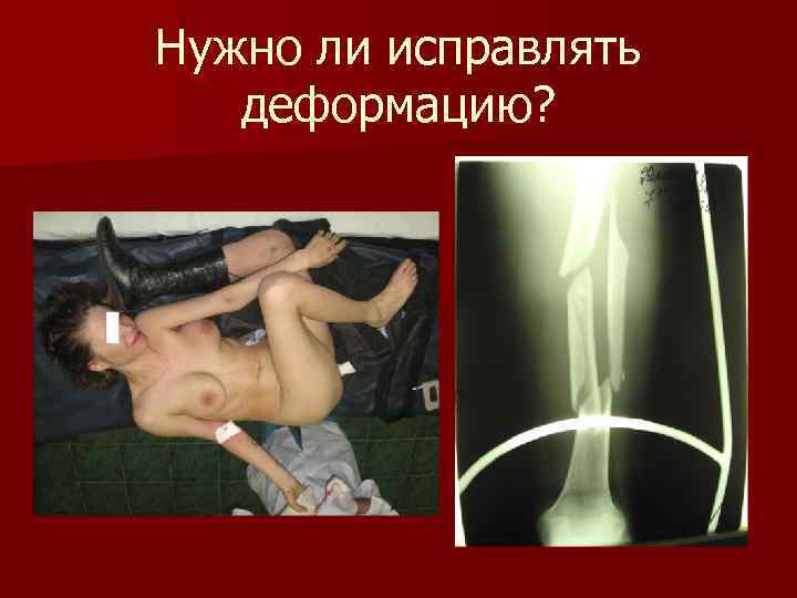 Нужно ли исправлять деформацию? 