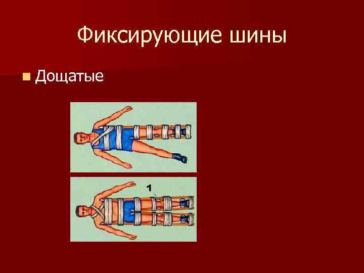 Фиксирующие шины n Дощатые 