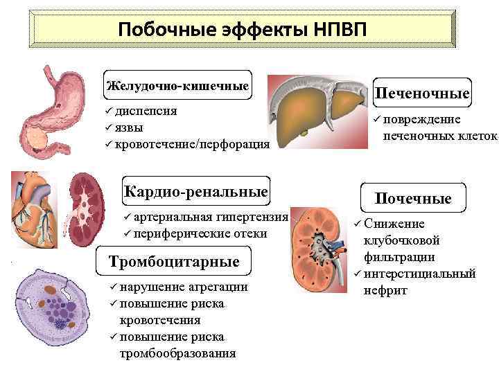 Побочные эффекты НПВП Желудочно-кишечные ü диспепсия ü язвы ü кровотечение/перфорация Кардио-ренальные ü артериальная гипертензия