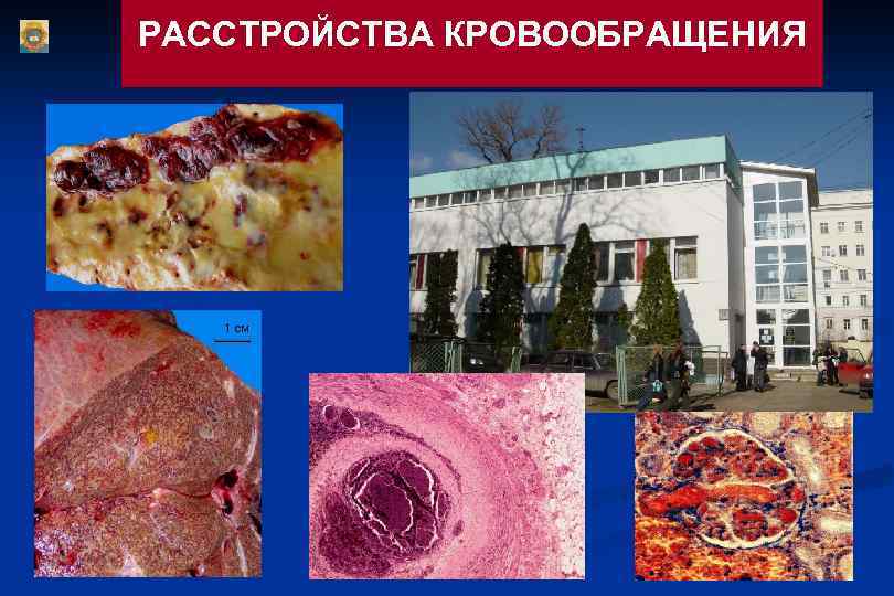 РАССТРОЙСТВА КРОВООБРАЩЕНИЯ 