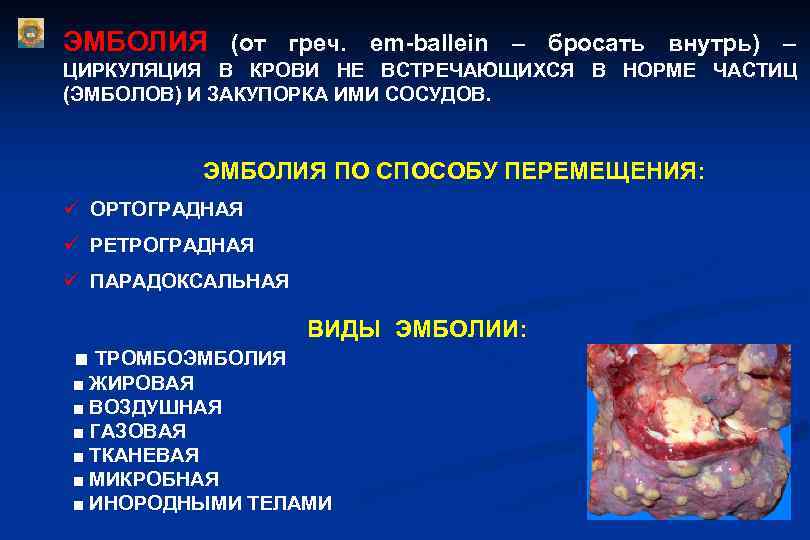 ЭМБОЛИЯ (от греч. em-ballein – бросать внутрь) – ЦИРКУЛЯЦИЯ В КРОВИ НЕ ВСТРЕЧАЮЩИХСЯ В