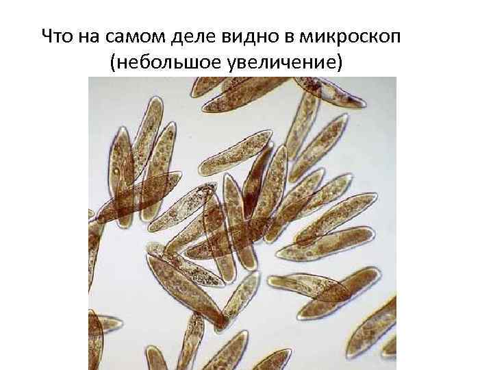 Что на самом деле видно в микроскоп (небольшое увеличение) 