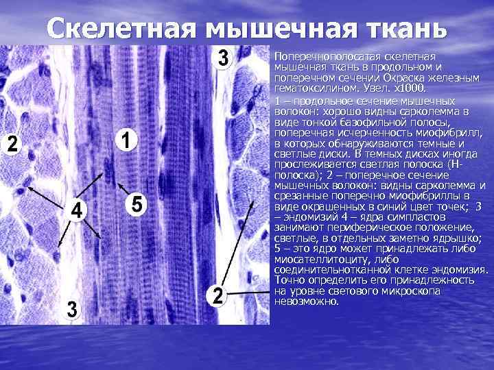 Поперечнополосатая мышечная ткань