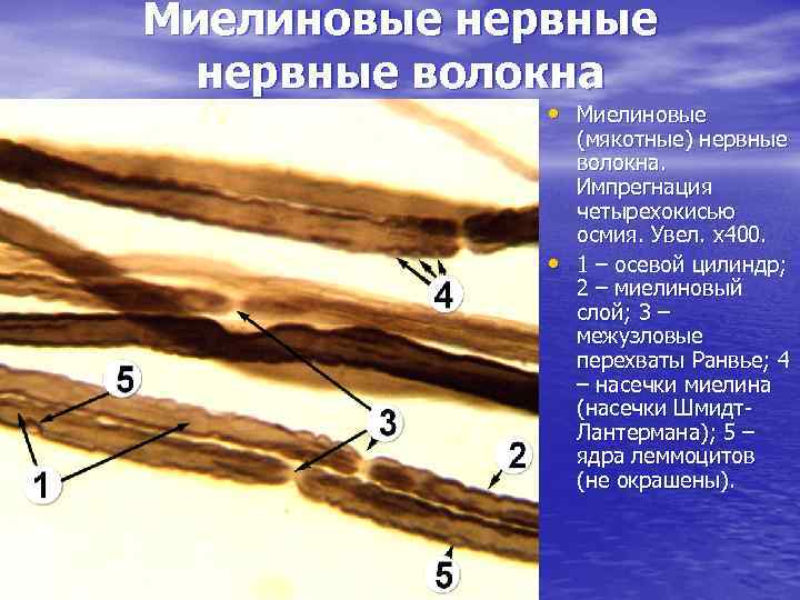 Миелиновые нервные волокна