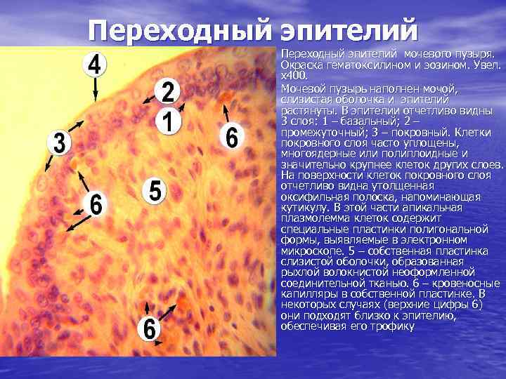 Переходный эпителий • Переходный эпителий мочевого пузыря. Окраска гематоксилином и эозином. Увел. х400. •