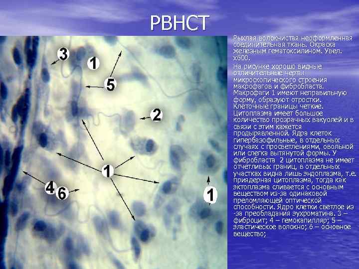 РВНСТ • Рыхлая волокнистая неоформленная соединительная ткань. Окраска железным гематоксилином. Увел. х600. • На