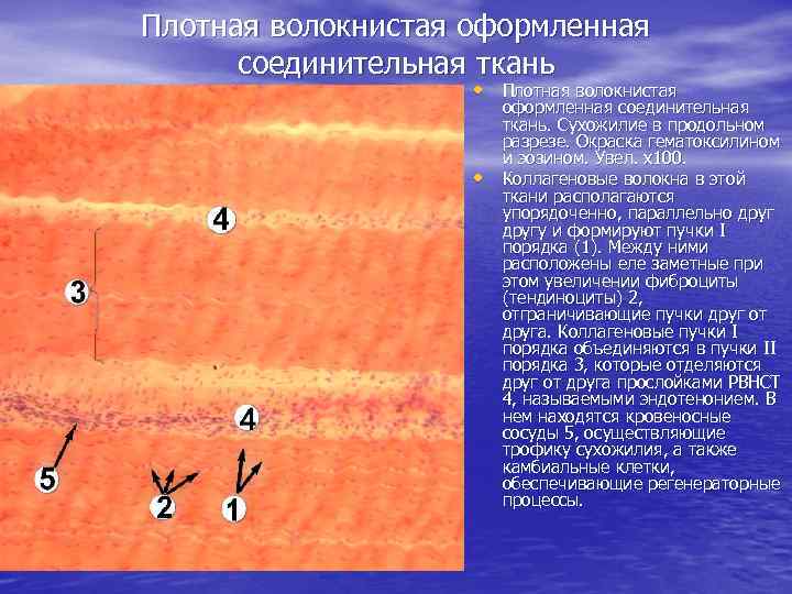 Плотная волокнистая оформленная соединительная ткань • Плотная волокнистая оформленная соединительная ткань. Сухожилие в продольном