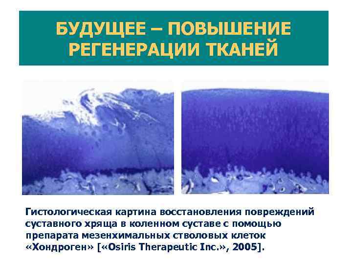 Объем продаж в области «stem cell therapy» в мире 