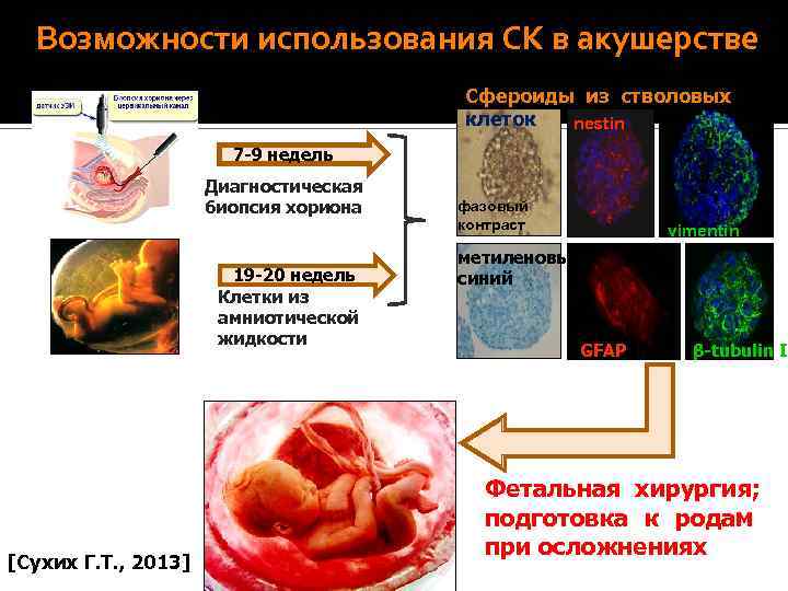  ТКАНЕВЫЕ МАТРИЦЫ ДЛЯ ИМПЛАНТАЦИИ Ультраструктура матриц, полученных из полигидрокси- бутирата, в форме волокон