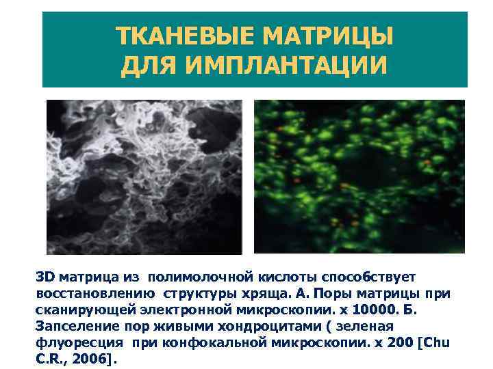 КОЛЛАПАН – ИССЛЕДОВАНИЕ В ВОЛГОГРАДЕ Формирование зрелого регенерата смешанного типа через 24 недели после