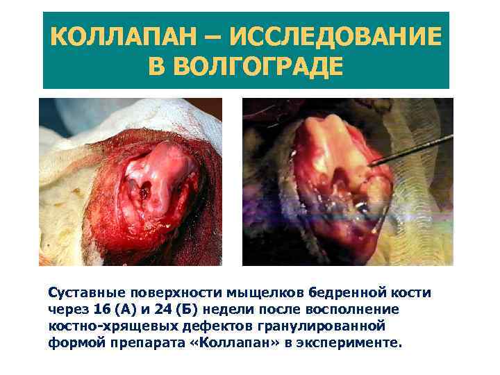  Нанотехнологии в тканевой инженерии суставов А. Элекроспининг. Б. Фазовая сепарация. В. Лиофилизация. Г.