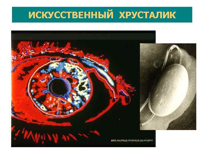 ИСКУССТВЕННОЕ СЕРДЦЕ? Доктор De Bakey держит в руках новую модель сердца, разработанную в NASA.