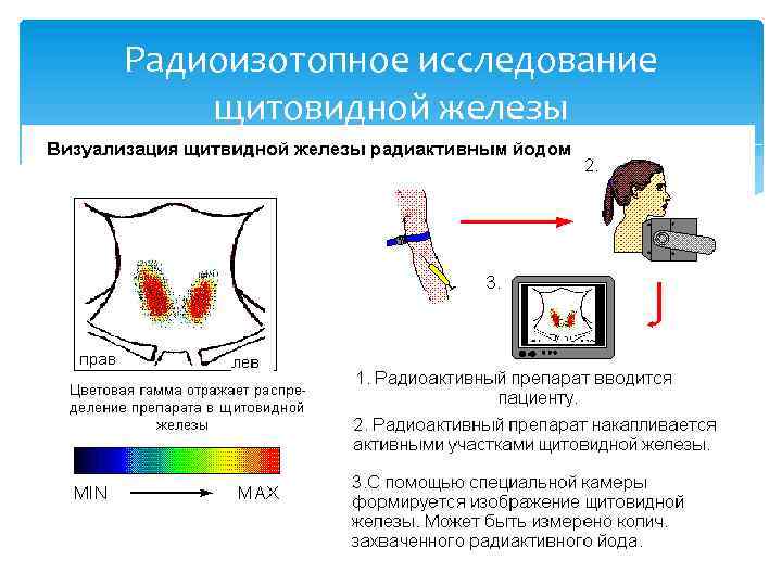 Радиоизотопное исследование щитовидной железы 