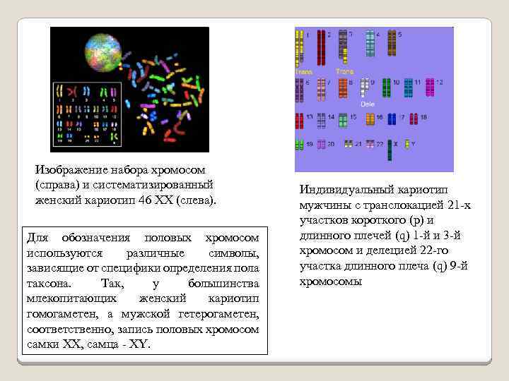 Изображение набора хромосом (справа) и систематизированный женский кариотип 46 XX (слева). Для обозначения половых