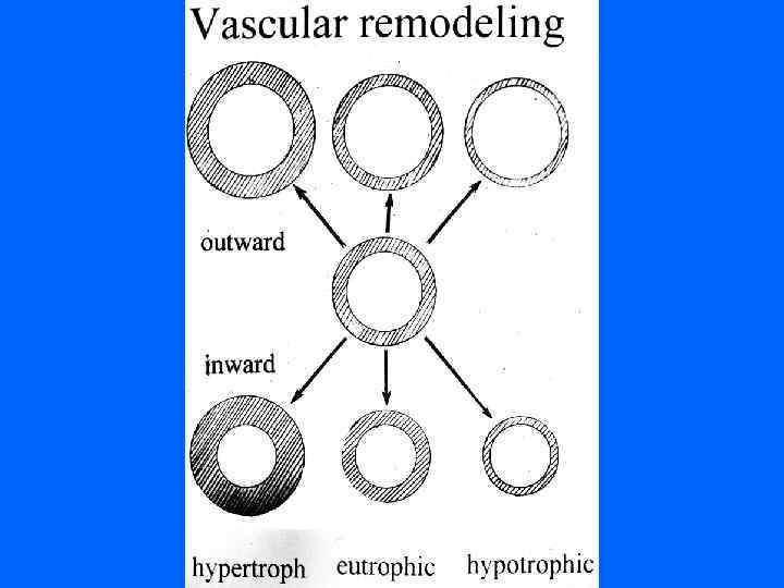  Ангиотензиноген Катепсин G Ренин Тонин Нефрилизин Тканевой Пролилэндопептидаза активатор Ангиотензин I плазминогена (t-
