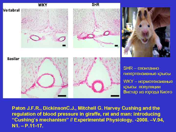 Сравнительные возможности различных механизмов регуляции АД в разные временные периоды от начала резкого изменения