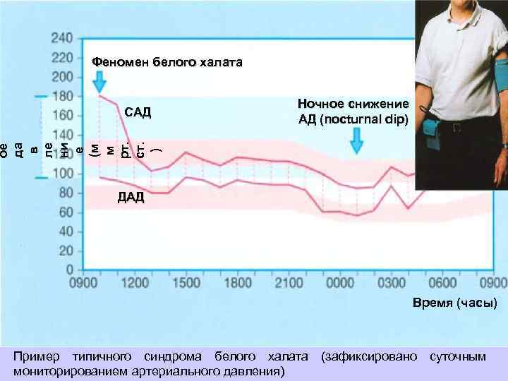  Возраст ≤ 49 лет 50 -69 лет ≥ 70 лет Мужчины САД (мм